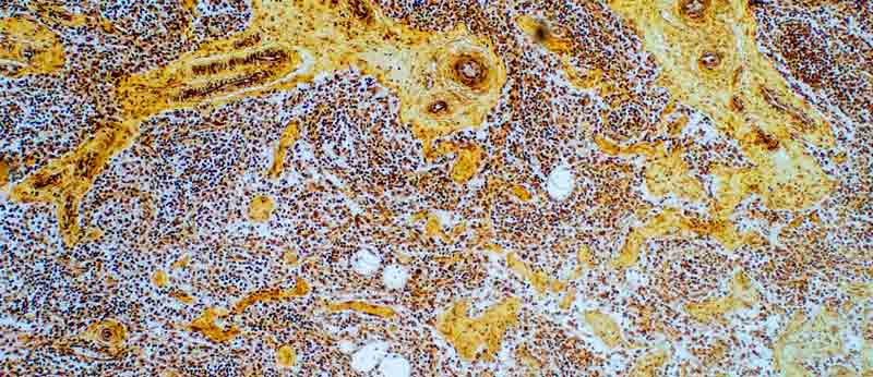 Cells showing liver scarring and how NMN helps improve their health.